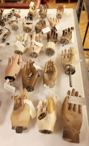 Prosthetics 