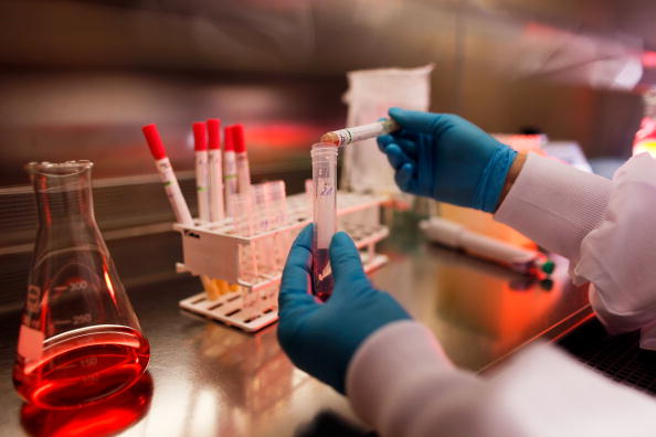Medical research has found biomarkers for chronic fatigue syndrome