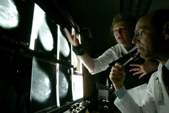 UCSF Cancer Center Uses Latest Technologies To Battle Cancer UCSF Cancer Center Uses Latest Technologies To Battle Cancer