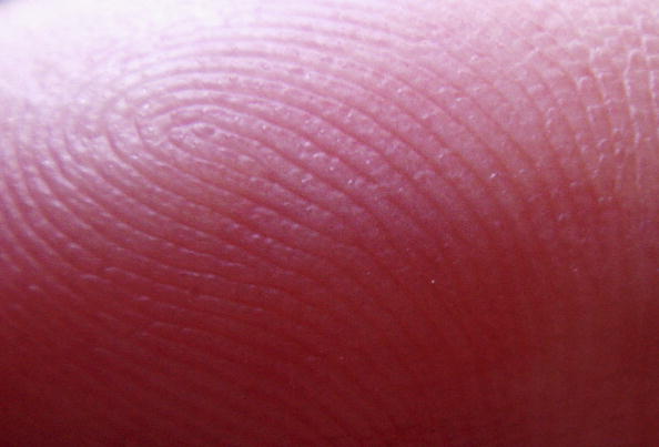 Fingerprints are unique to each individual, but a women undergoing chemotherapy recently lost hers. 