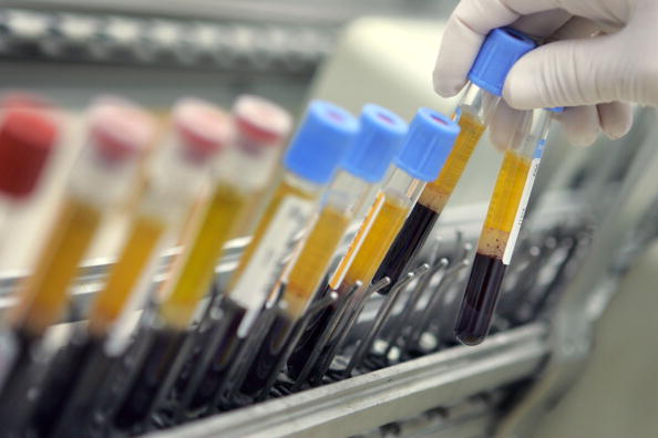 Israeli Laboratory Leads Western World In Blood Testing Israeli Laboratory Leads Western World In Blood Testing