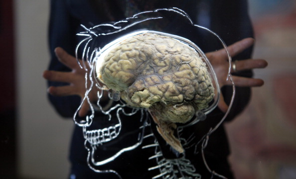 Brain Brain