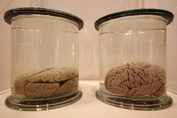 The Wellcome Collections Unveils Their New Exhibition Brains The Wellcome Collections Unveils Their New Exhibition Brains