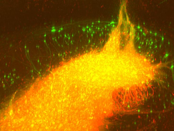 Transplant of Human Neurons in the Hippocampus of a Mouse Transplant of Human Neurons in the Hippocampus of a Mouse