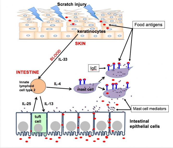 Scratching and Mast Cells (IMAGE) Scratching and Mast Cells (IMAGE)