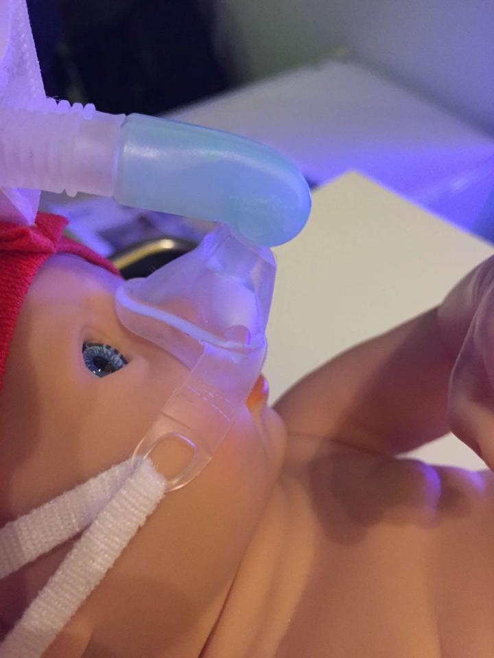 New Noninvasive Ventilation Strategy Allows Preterm Infants to Breathe Freely (IMAGE) New Noninvasive Ventilation Strategy Allows Preterm Infants to Breathe Freely (IMAGE)