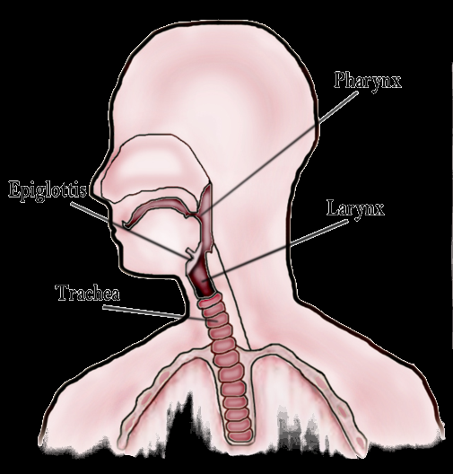 A man in Poland has undergone a throat transplant, which includes the trachea, esophagus, and larynx. 