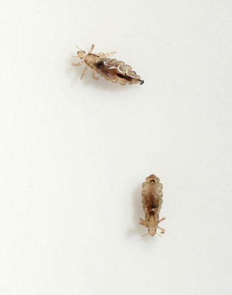 A pair of head lice. Head lice are actually about the size of a sesame seed. 