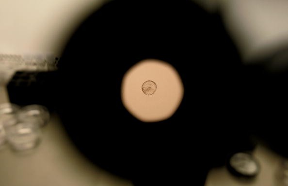 A human embryo, as seen through a microscope. 