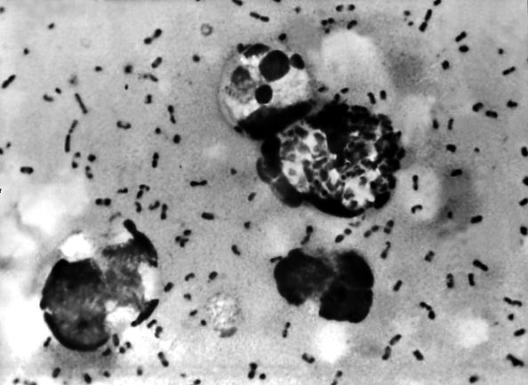 A microscopic look at the bacterium that causes plague. 