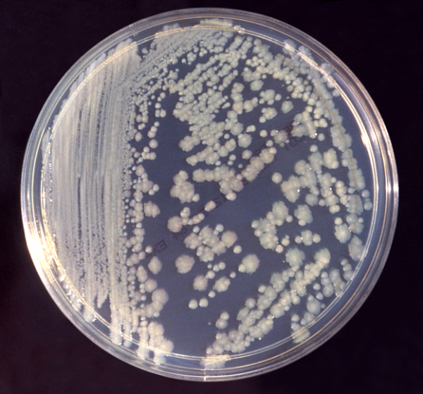 A petri dish of Enterobacter bacteria, the kind that appear to take over in a small sample of burn patients.