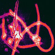 Fragments of the Ebola virus. A vaccine against Ebola looks promising. 