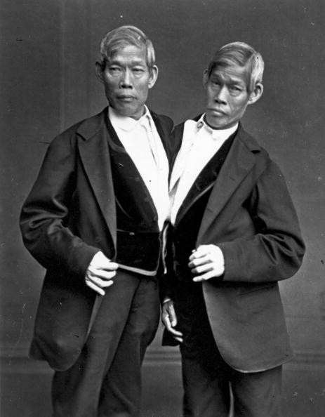 Chang and Eng Bunker, conjoined twins who made their living in exhibits and gave rise to the term Siamese Twins.