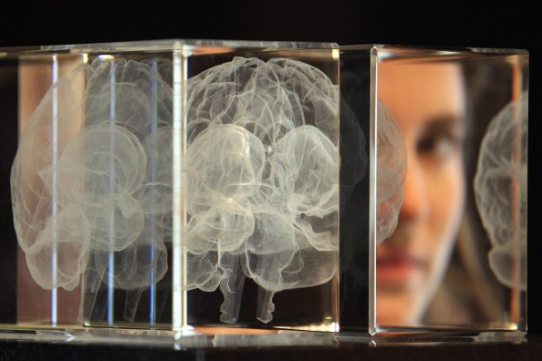 Brain volume has a weak association with IQ score