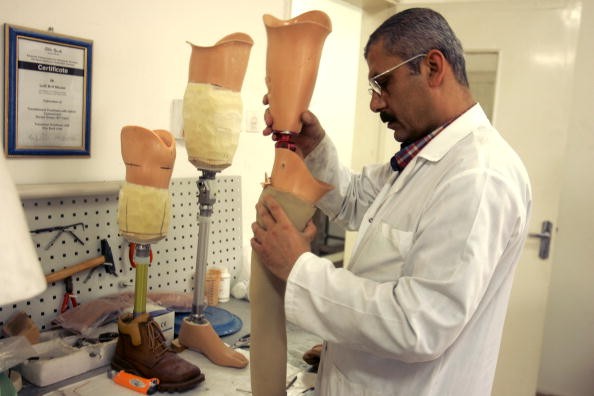 Prosthetic limbs may now be on its way after an 'artificial skin' showed natural-like function