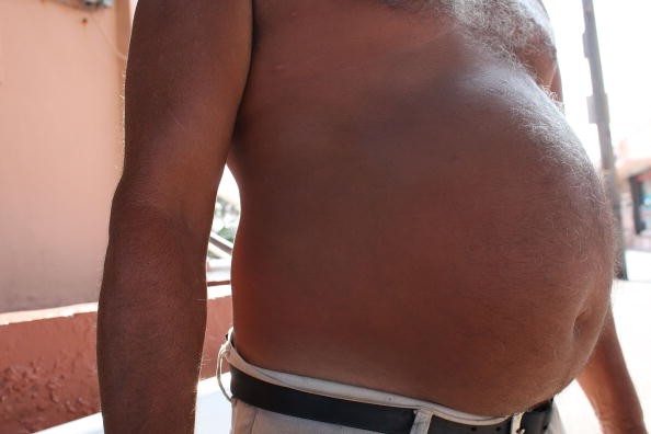 Carrying your weight around your abdomen, like this man here, is a risk factor for heart disease and death. 