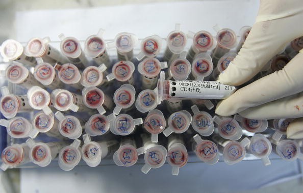 Vials of blood being tested for sexually transmitted diseases. 