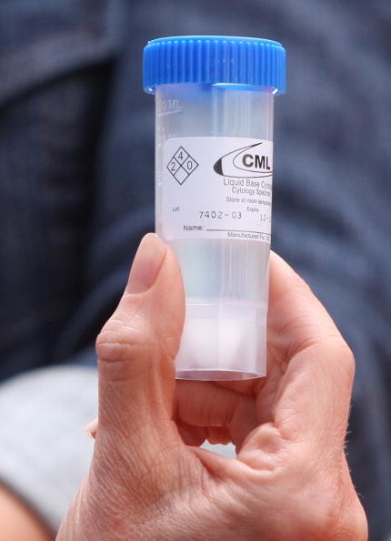 A vial containing a Pap smear, the test that screens for cervical cancer. 