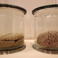 The Wellcome Collections Unveils Their New Exhibition Brains