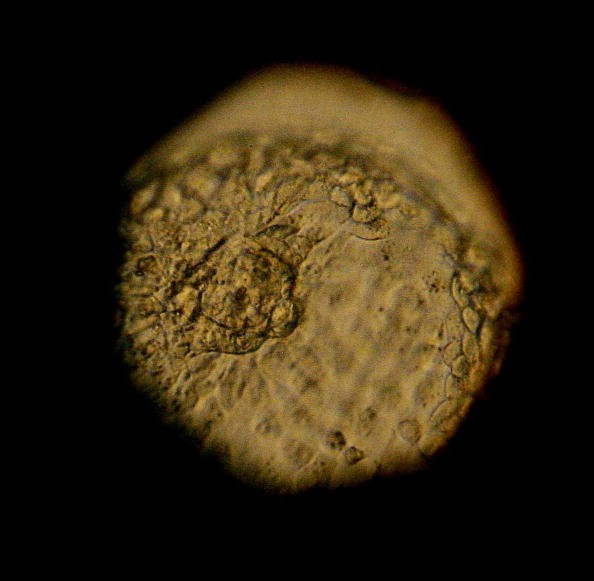 A human embryo under a microscope. 