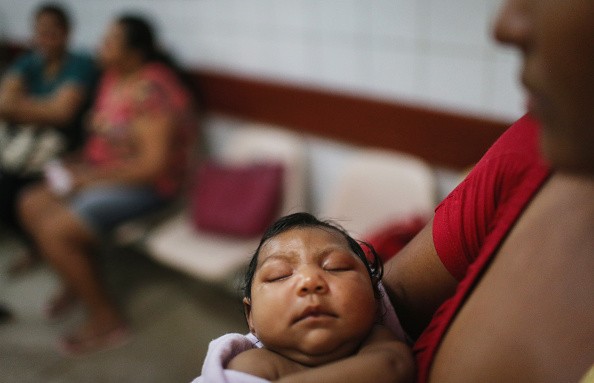 A Brazilian baby with microcephaly (a too small head), thought to be caused by a Zika infection in her mother during pregnancy.