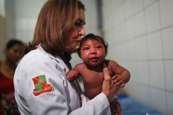 Brazilian Neurologist Provides Alarm To Zika And  Microcephaly Correlation In Infants