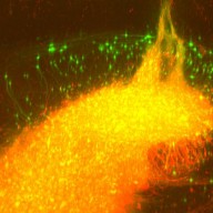 Transplant of Human Neurons in the Hippocampus of a Mouse