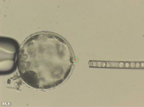 Human iPS Cells in a Pig Blostocyst 