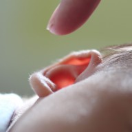 Hearing loss is common after infant heart surgery