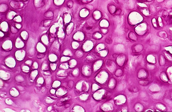 Chondrocytes (IMAGE)