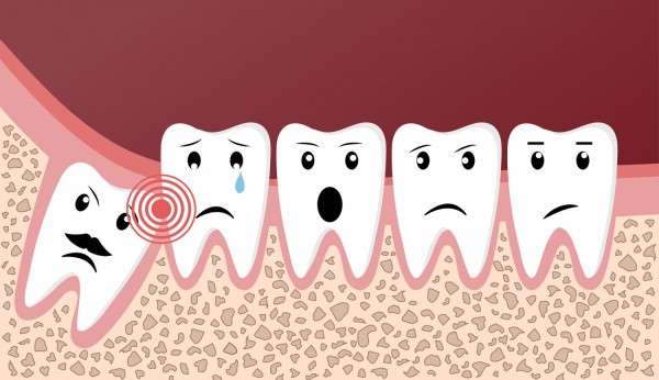 Wisdom teeth and dental problems