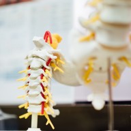 How to avoid spine surgery if you had such cases in your family?