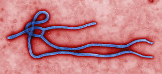 Ebola virus, magnified