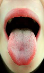 Your tongue tells your doctor a lot about your health. 