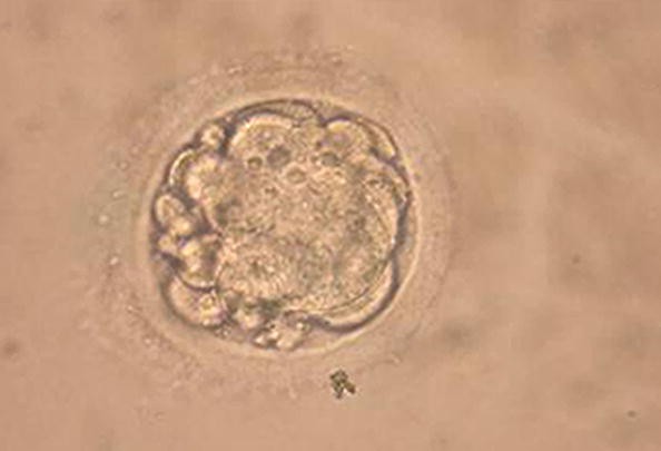 A human enbryo. 